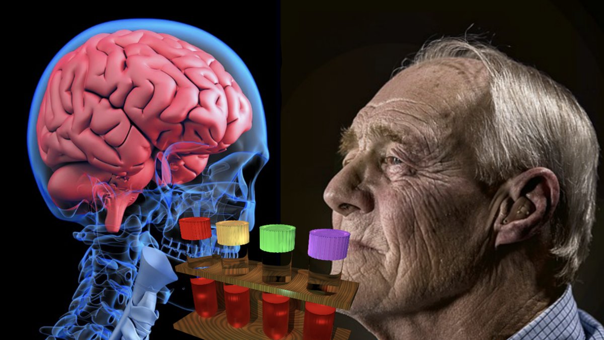 Botemedel mot Alzheimers kan ha upptäckts.